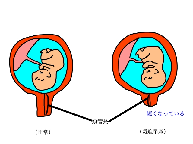 乳房嚢切除術の手順